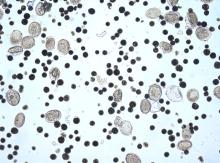 japonicum and magnetic beads